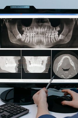 Dentista realizando atendimento odontológico domiciliar em paciente idoso acamado