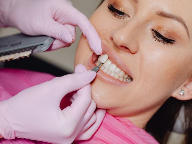 Comparação entre lente de contato dental, faceta de porcelana e faceta de resina composta